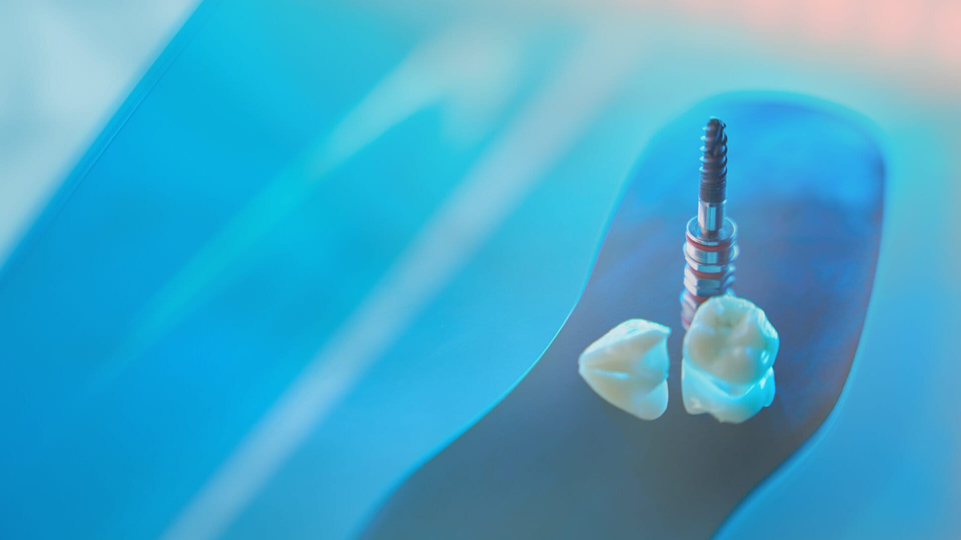 Mavi yüzey üzerinde iki seramik kronun yanında dik duran titanyum implant vidası
