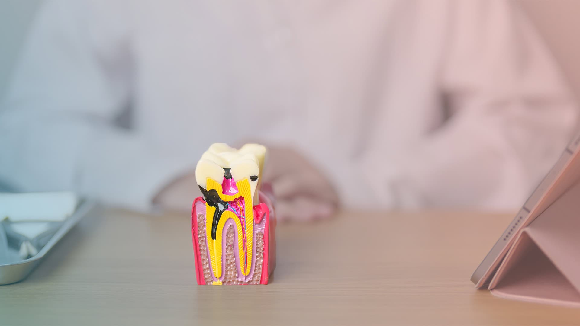 Masadaki diş kesit modelinde siyah çürük, dişin içindeki pembe sinir dokusuna uzanıyor