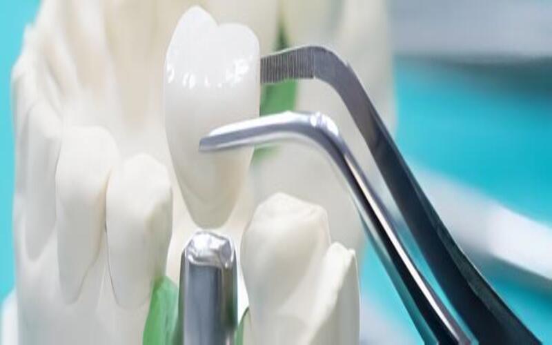 Diş modeli üzerinde metal el aletiyle çalışılıyor, yakın çekim
