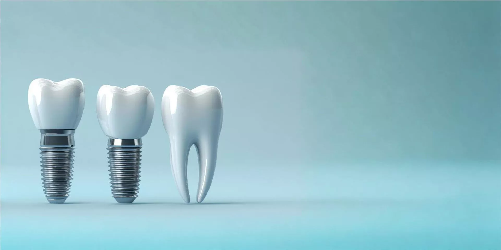 dental implants category img