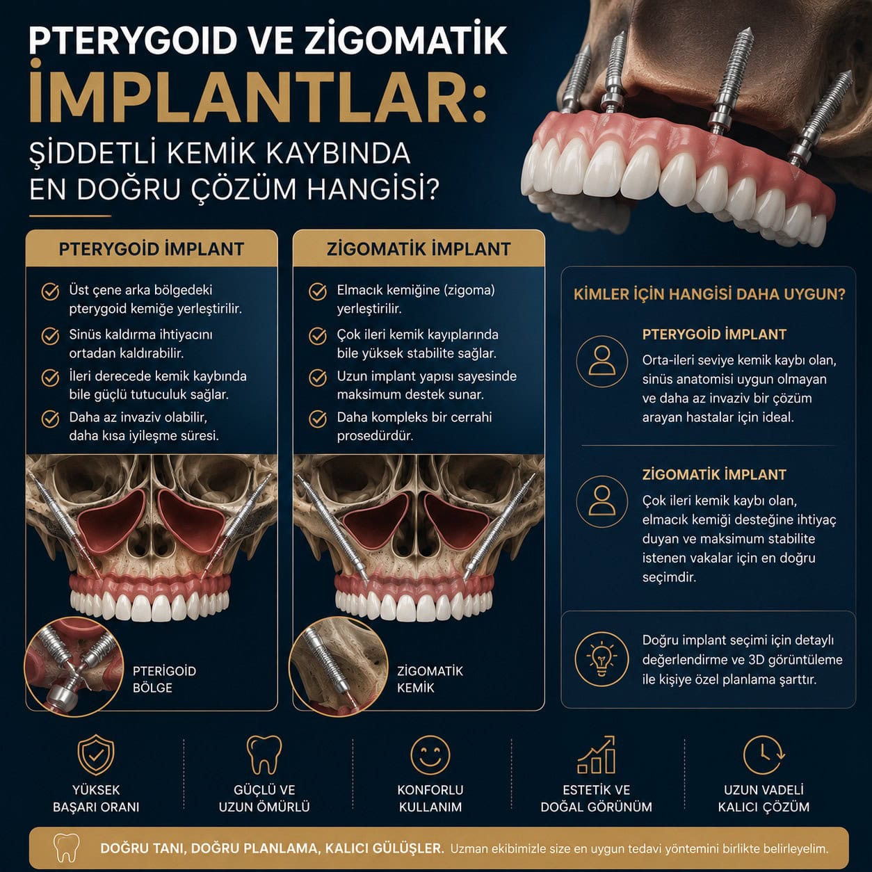Pterygoid ve Zigomatik İmplantlar: Şiddetli Kemik Kaybında En Doğru Çözüm Hangisi?