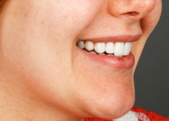 7 numaralı vaka · tedavi sonrası ağız içi yakın çekim