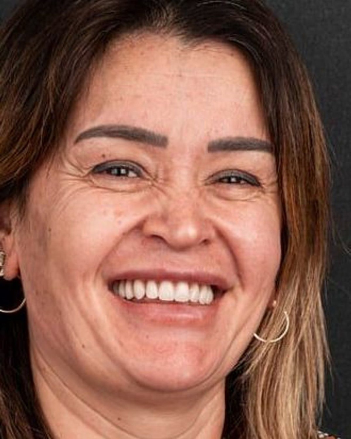 10 numaralı vaka · tedavi sonrası gülüş portresi