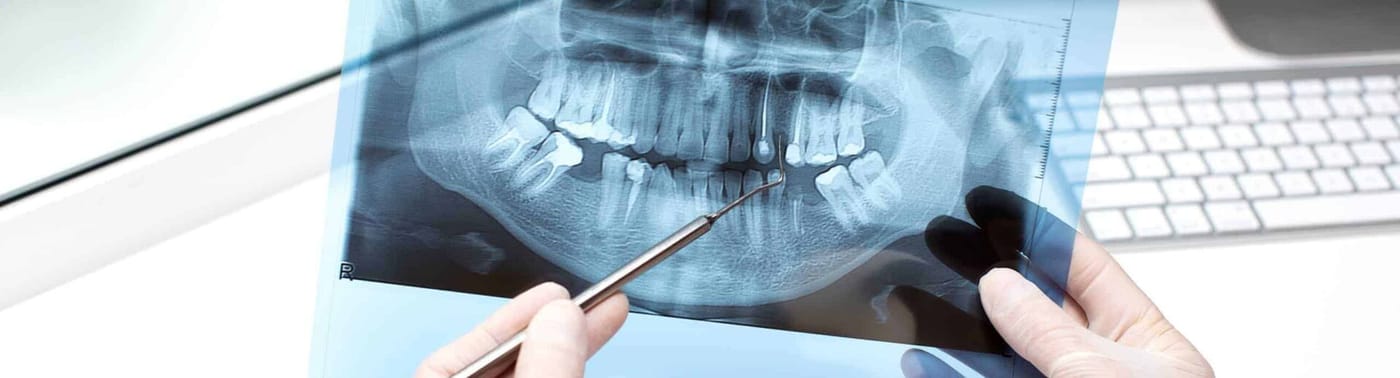 Dental Radyoloji